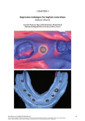 241-KOURTIS-Introduction-to-implant-prosthodontics-ch04.pdf.jpg