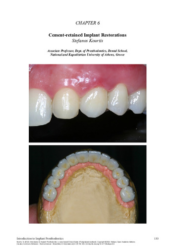 241-KOURTIS-Introduction-to-implant-prosthodontics-ch06.pdf.jpg