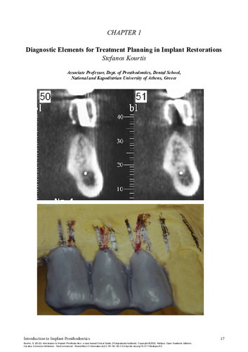 241-KOURTIS-Introduction-to-implant-prosthodontics-ch01.pdf.jpg