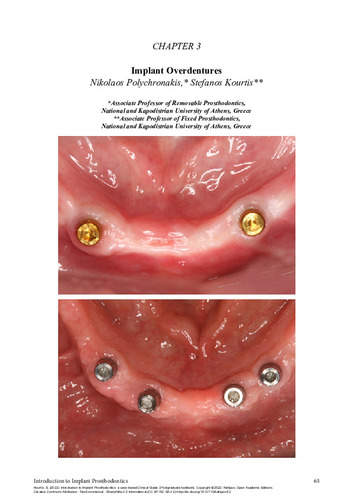 241-KOURTIS-Introduction-to-implant-prosthodontics-ch03.pdf.jpg