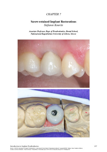 241-KOURTIS-Introduction-to-implant-prosthodontics-ch07.pdf.jpg
