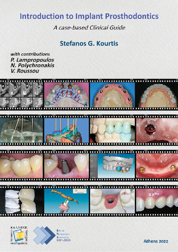 241-KOURTIS-Introduction-to-implant-prosthodontics.pdf.jpg