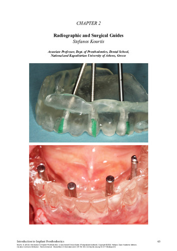 241-KOURTIS-Introduction-to-implant-prosthodontics-ch02.pdf.jpg